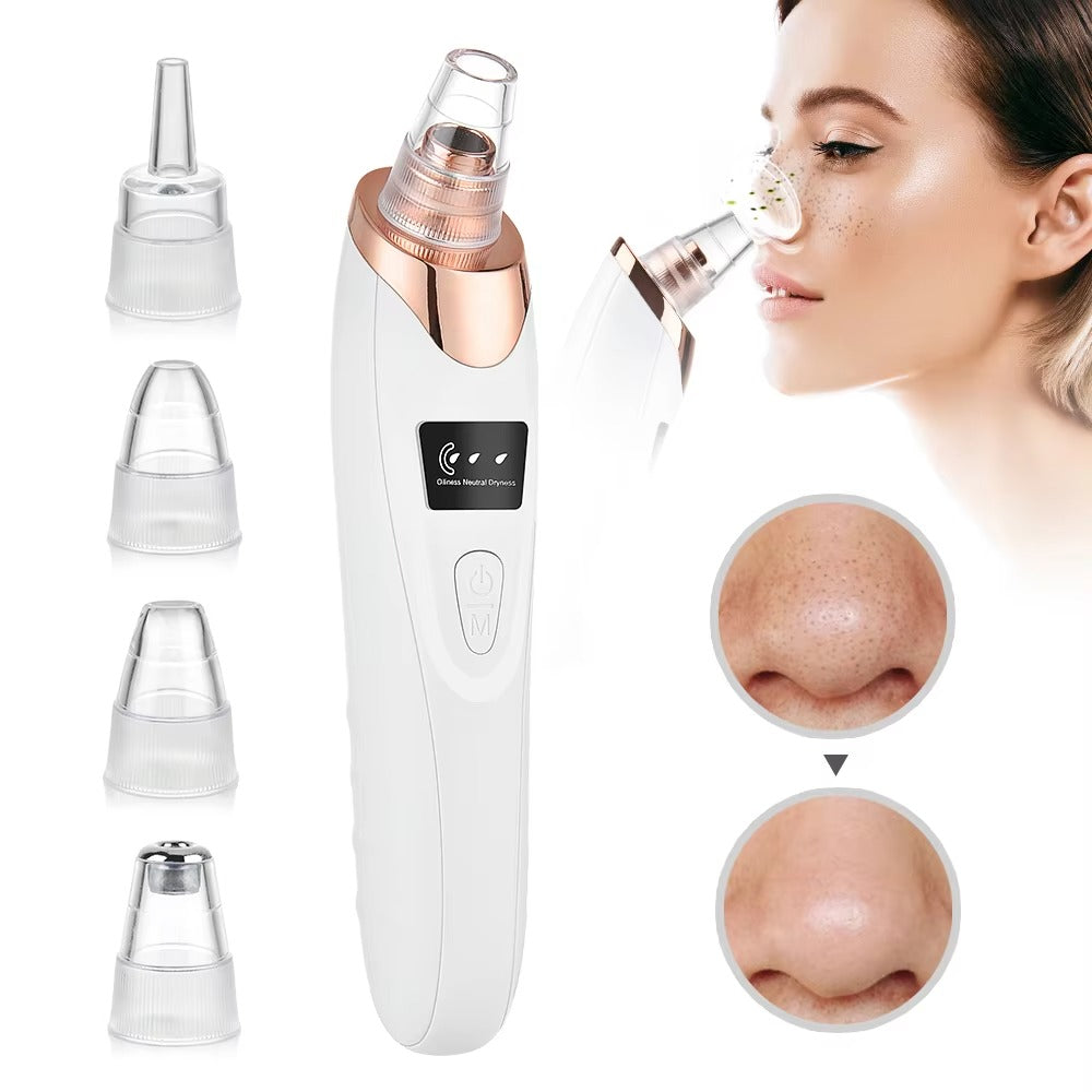 Blackhead Remover Machine – Deep Cleaning Vacuum for Acne & Pores | Skin Care Tool